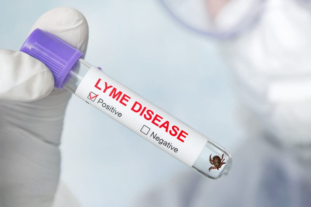 Lyme disease positive test tube with tick in southern Maine laboratory setting